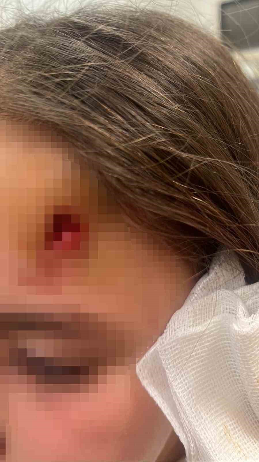 Beylikdüzü’nde okul çıkışında dehşeti yaşadılar: Ters yönden gelen scooter, kadına ve çocuğa çarptı; o anlar kamerada 9 beylikduzunde okul cikisinda dehseti yasadilar ters yonden gelen scooter kadina ve cocuga carpti o