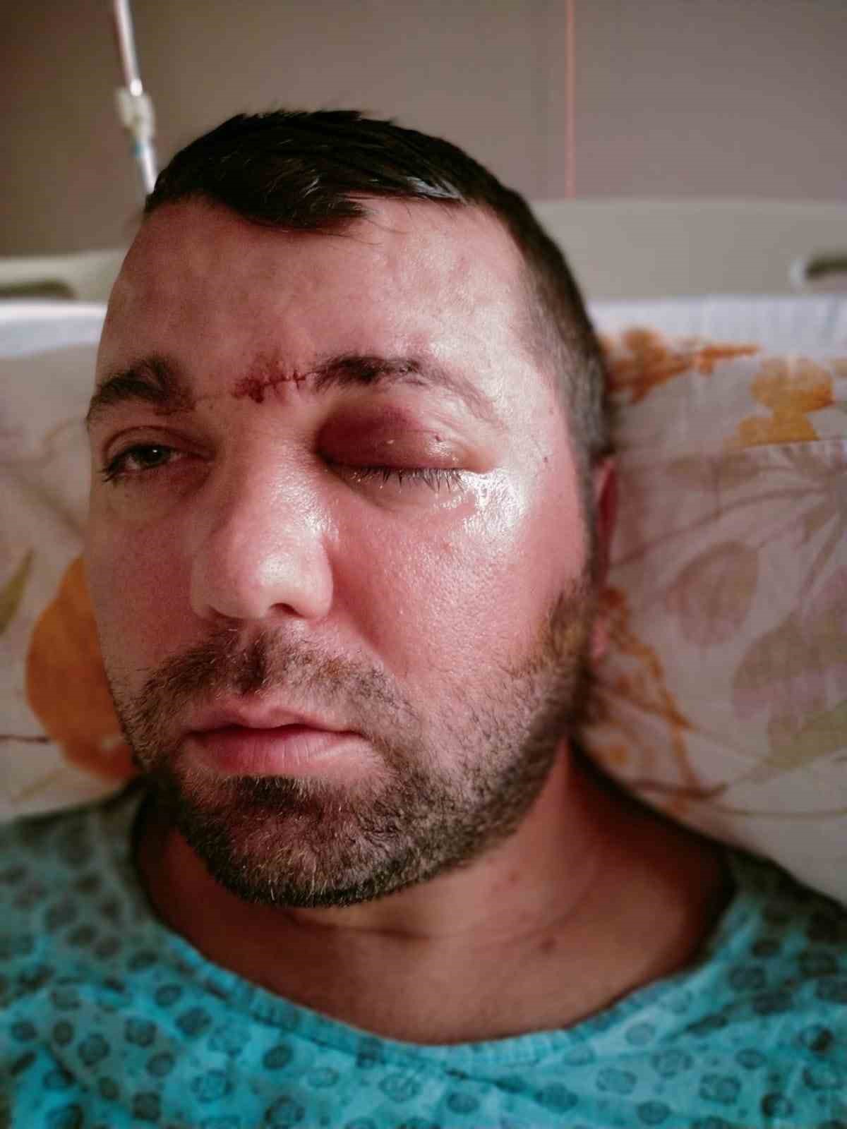 beynine saplanan implant hayatini karartti 2 yildir adalet bekliyor 5