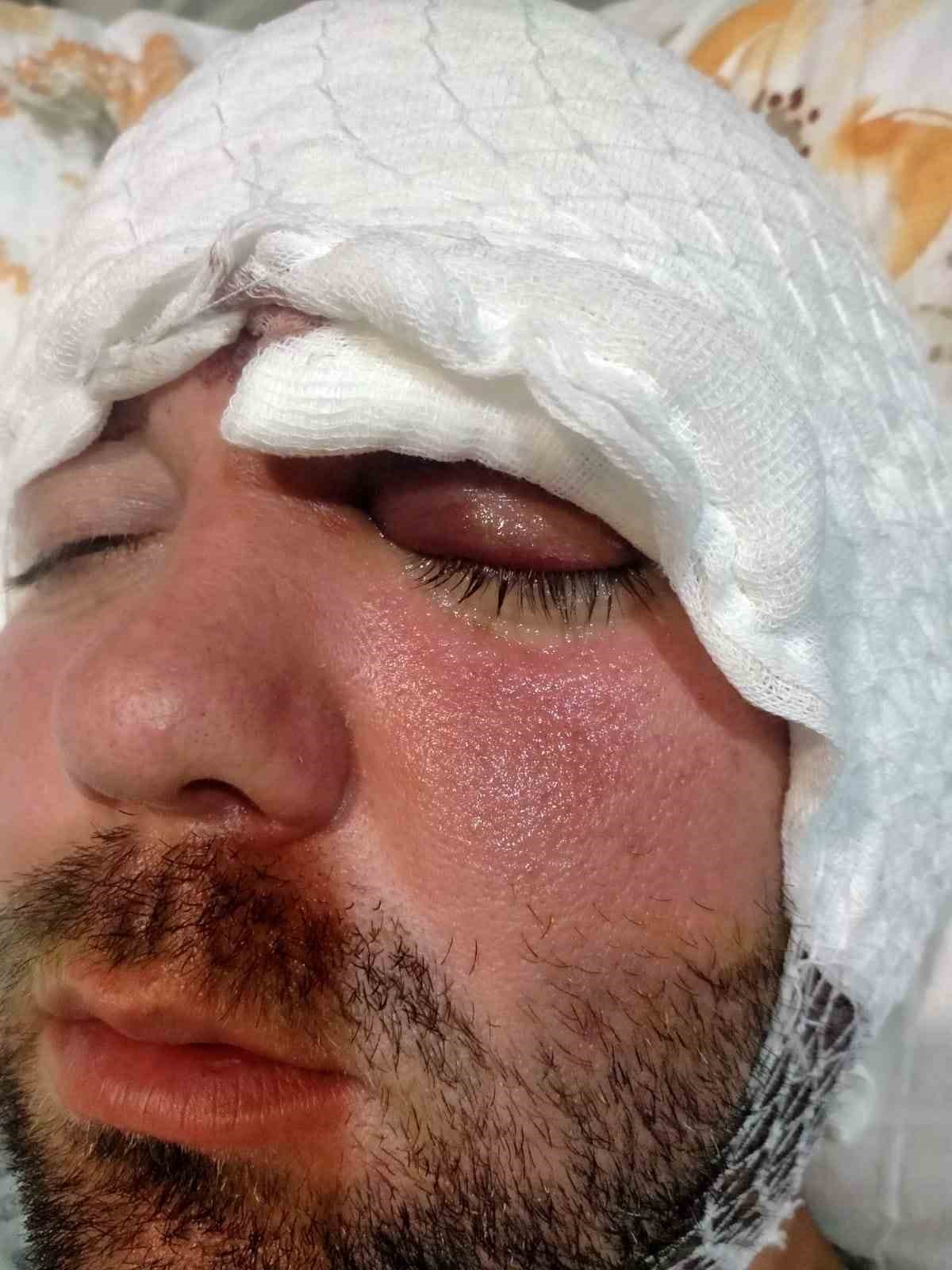 beynine saplanan implant hayatini karartti 2 yildir adalet bekliyor 6 v9gQKnhE