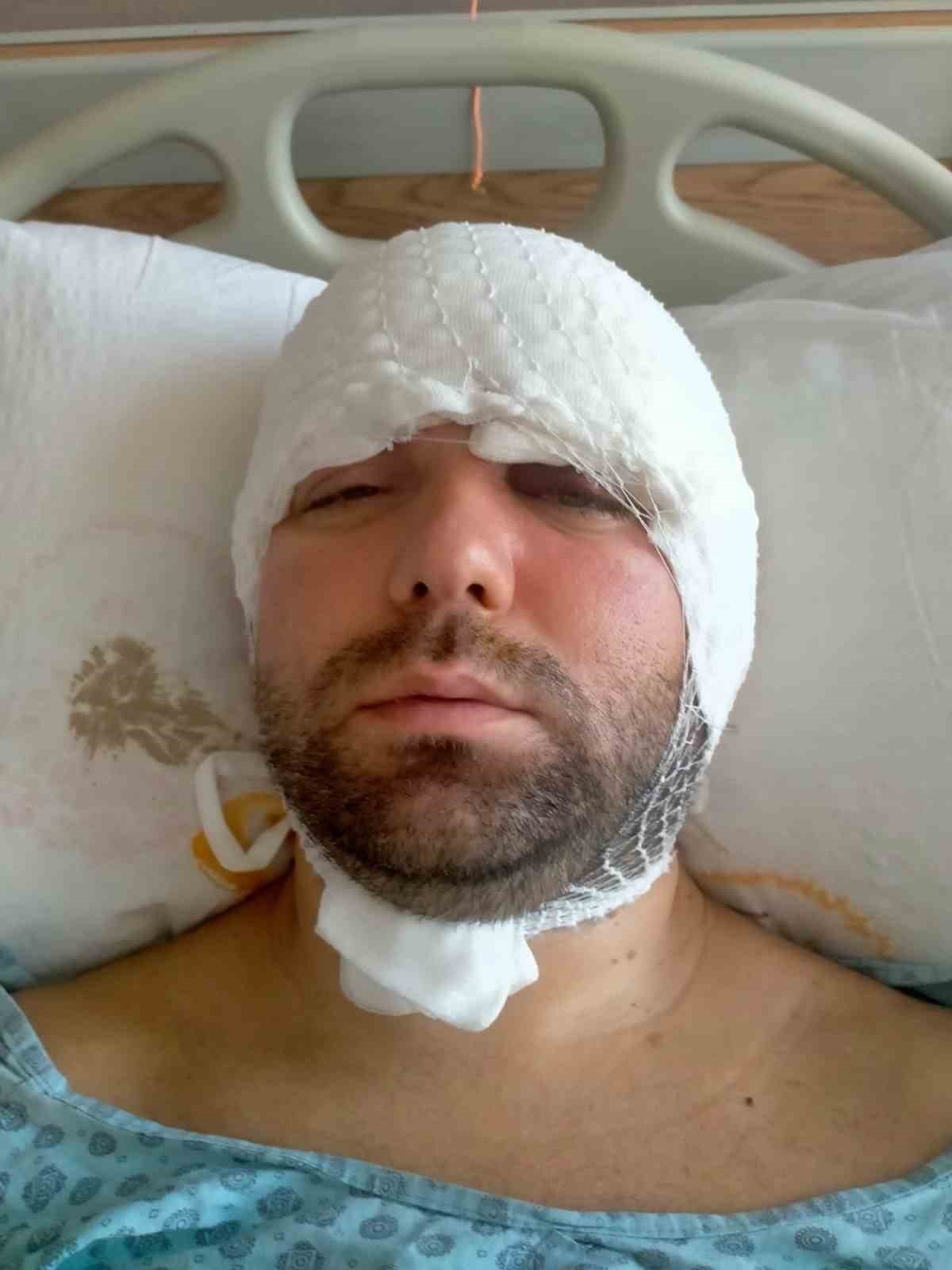 beynine saplanan implant hayatini karartti 2 yildir adalet bekliyor 7 dK84BYrD