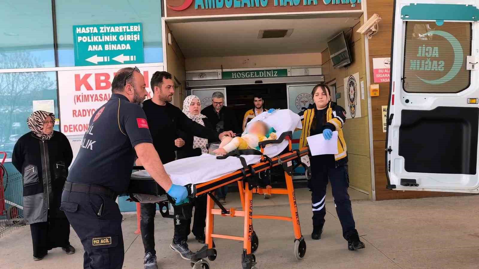 bursada kaynar su uzerine dokulen 9 aylik bebek agir yaralandi 3 d4iC5IEW