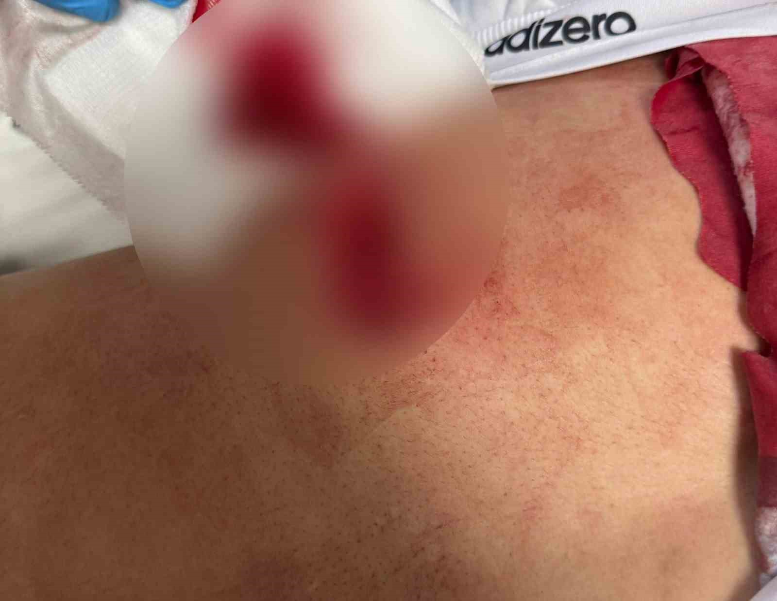 bursada parkta cikan tartismada kan akti sirtindan bicaklanarak yaralandi 1 DEyD2aRt