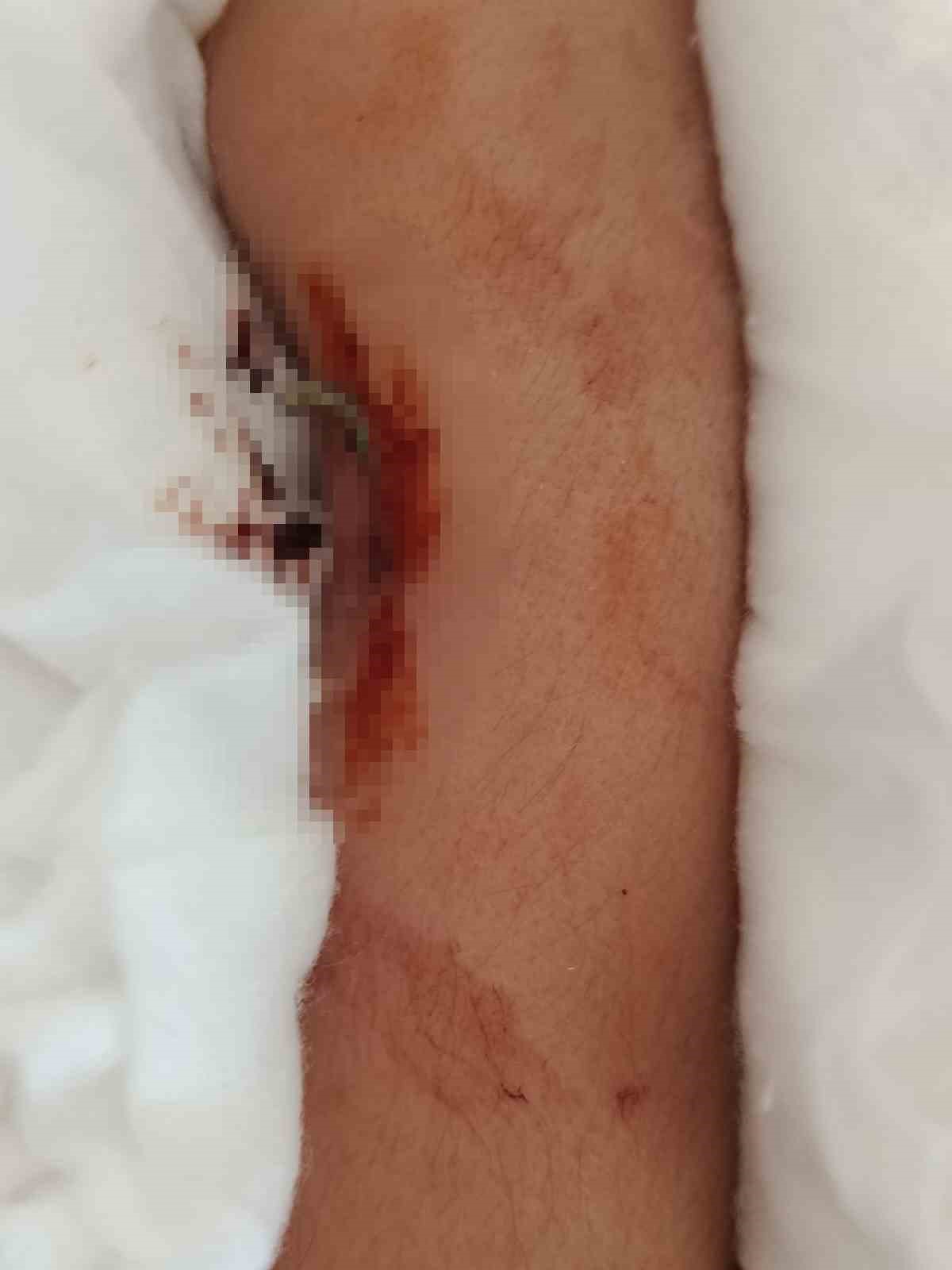 buyukcekmecede akran zorbaligi arkadasinin kolunu 2 yerden kirdi 2 w8KMurCU