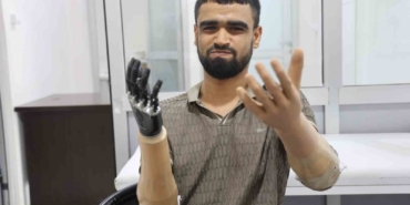 demirin-elektrik-tellerine-degmesiyle-hayati-kararan-muhammed-3-milyon-tl-degerindeki-protez-bacagina-ve-2bNHs248.jpg