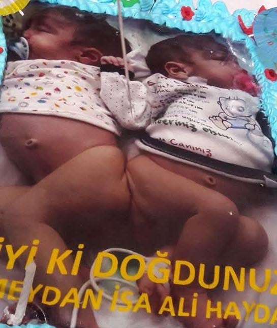 Depremle birlikte öksüz ve yetim kalan siyam ikizi kardeşleri 9 yaşında ölüm ayırdı 12 depremle birlikte oksuz ve yetim kalan siyam ikizi kardesleri 9 yasinda olum ayirdi 8 jdiky35t