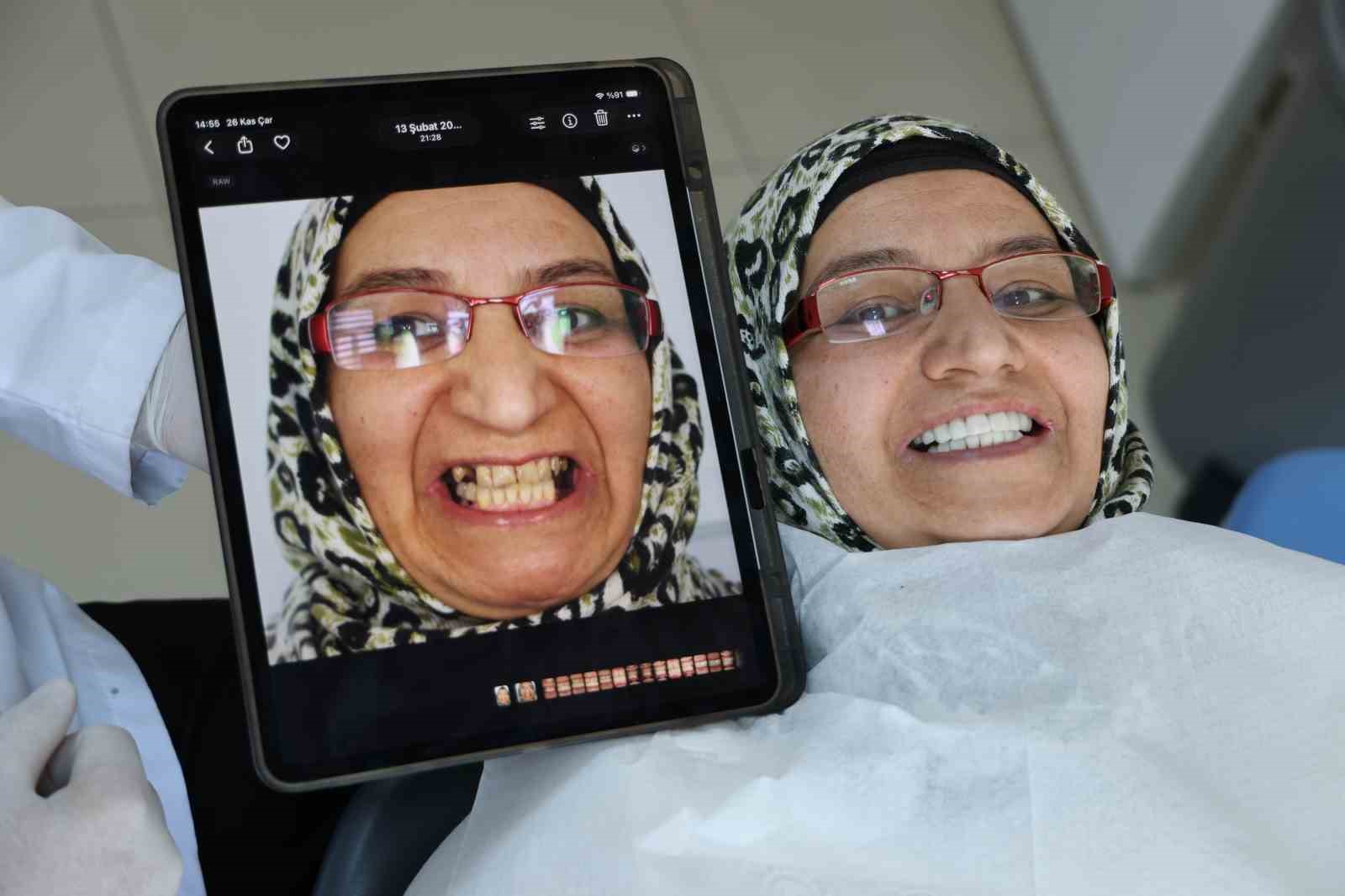 Depremlerden etkilendi, diş tedavisinde implantı rafa kaldıracak cam fiber uygulamasını geliştirdi 5 depremlerden etkilendi dis tedavisinde implanti rafa kaldiracak cam fiber uygulamasini gelistirdi 1 64qGJghY