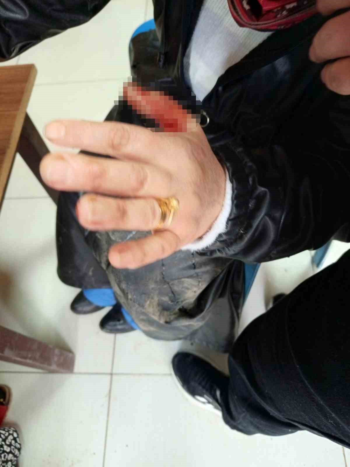 diyarbakirda basibos sokak kopegi dehseti 1 qOy4jjX7