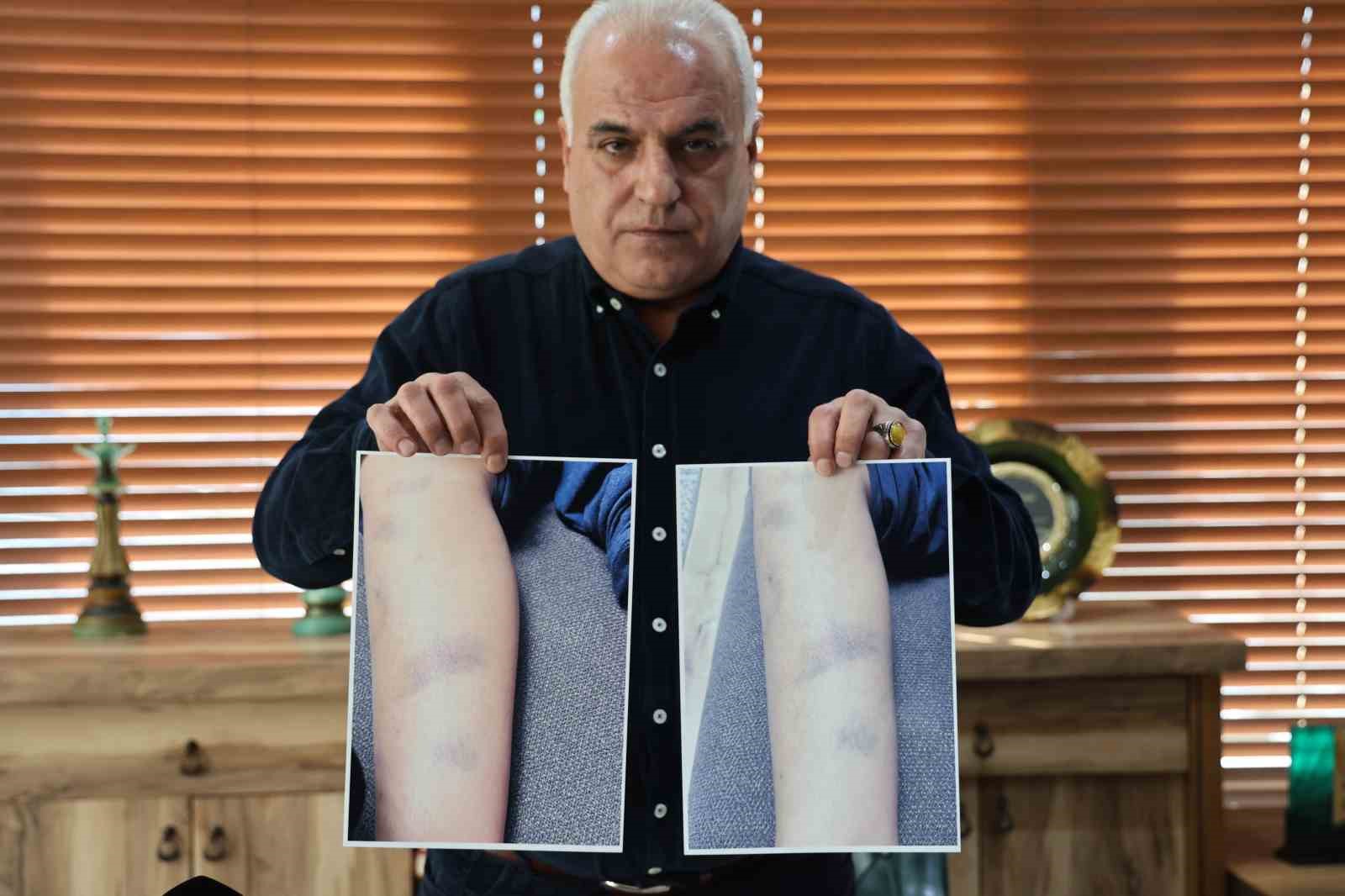 diyarbakirda ozel okulda 8 yasindaki cocugun darbedildigi iddiasi 1 TvLMdrSe