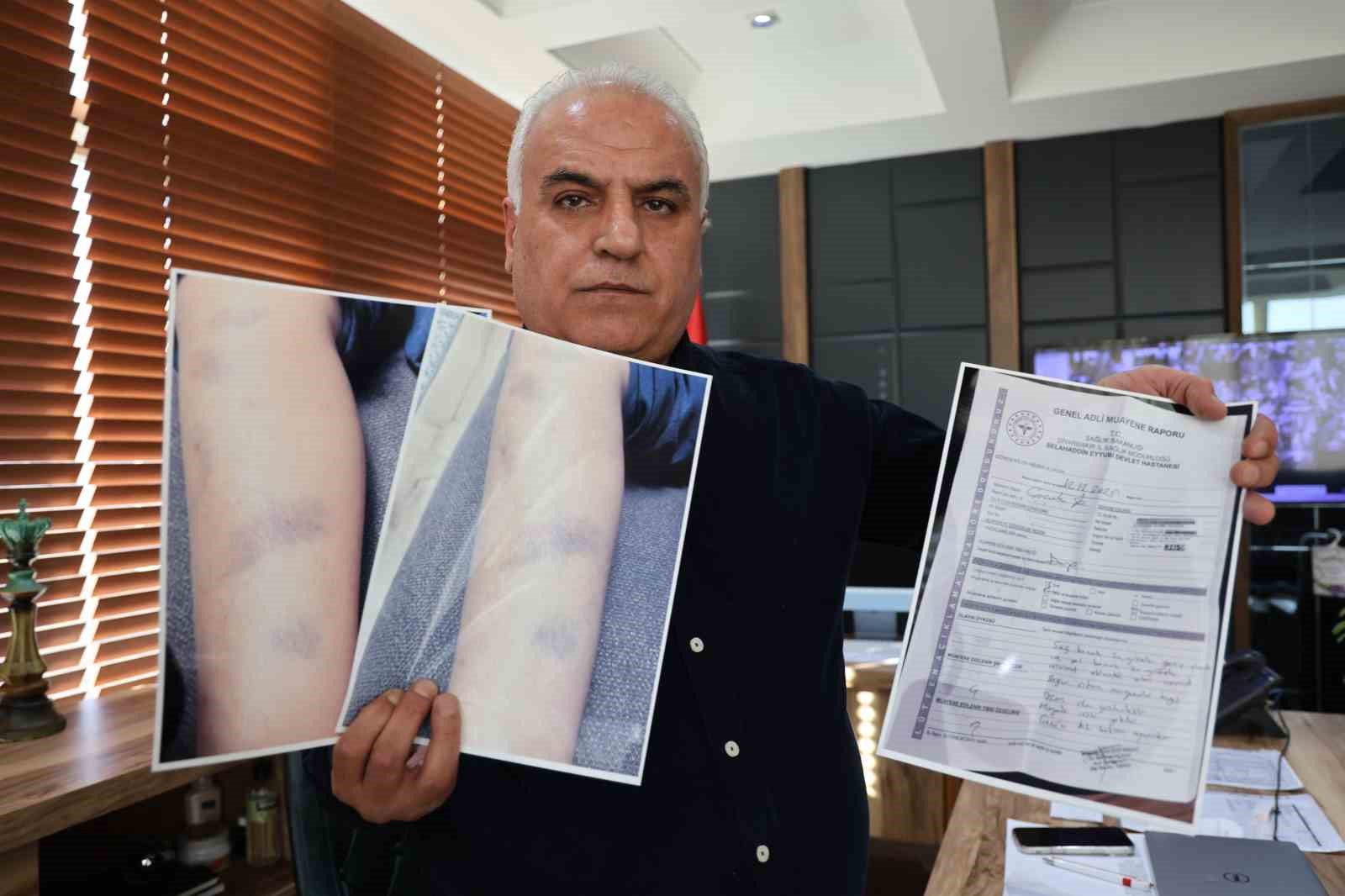 diyarbakirda ozel okulda 8 yasindaki cocugun darbedildigi iddiasi 2 G7TmZIGp