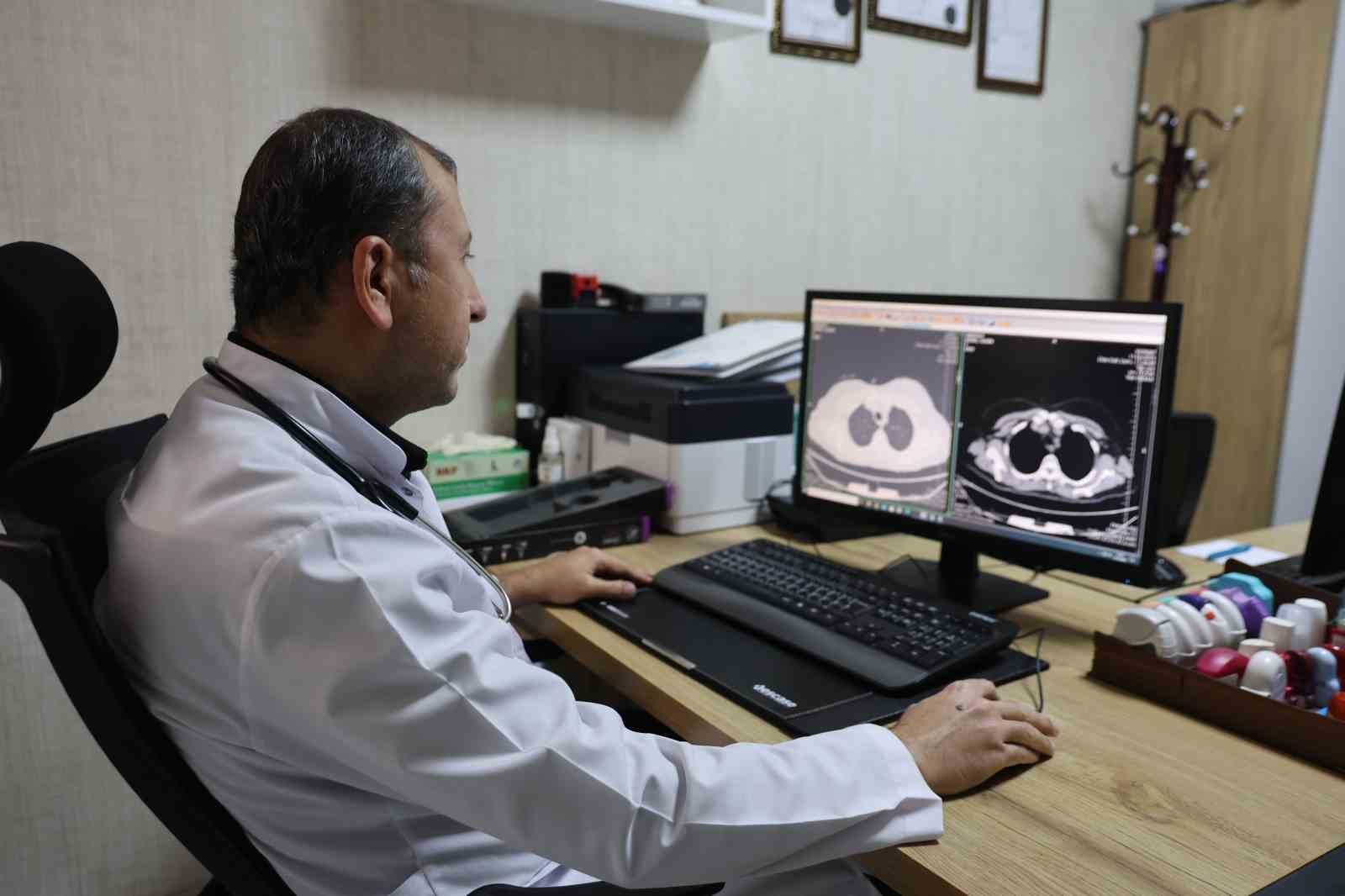 doc dr erden dunyada her yil yaklasik 2 bucuk milyon insana akciger kanseri teshisi Xn5WHFgG