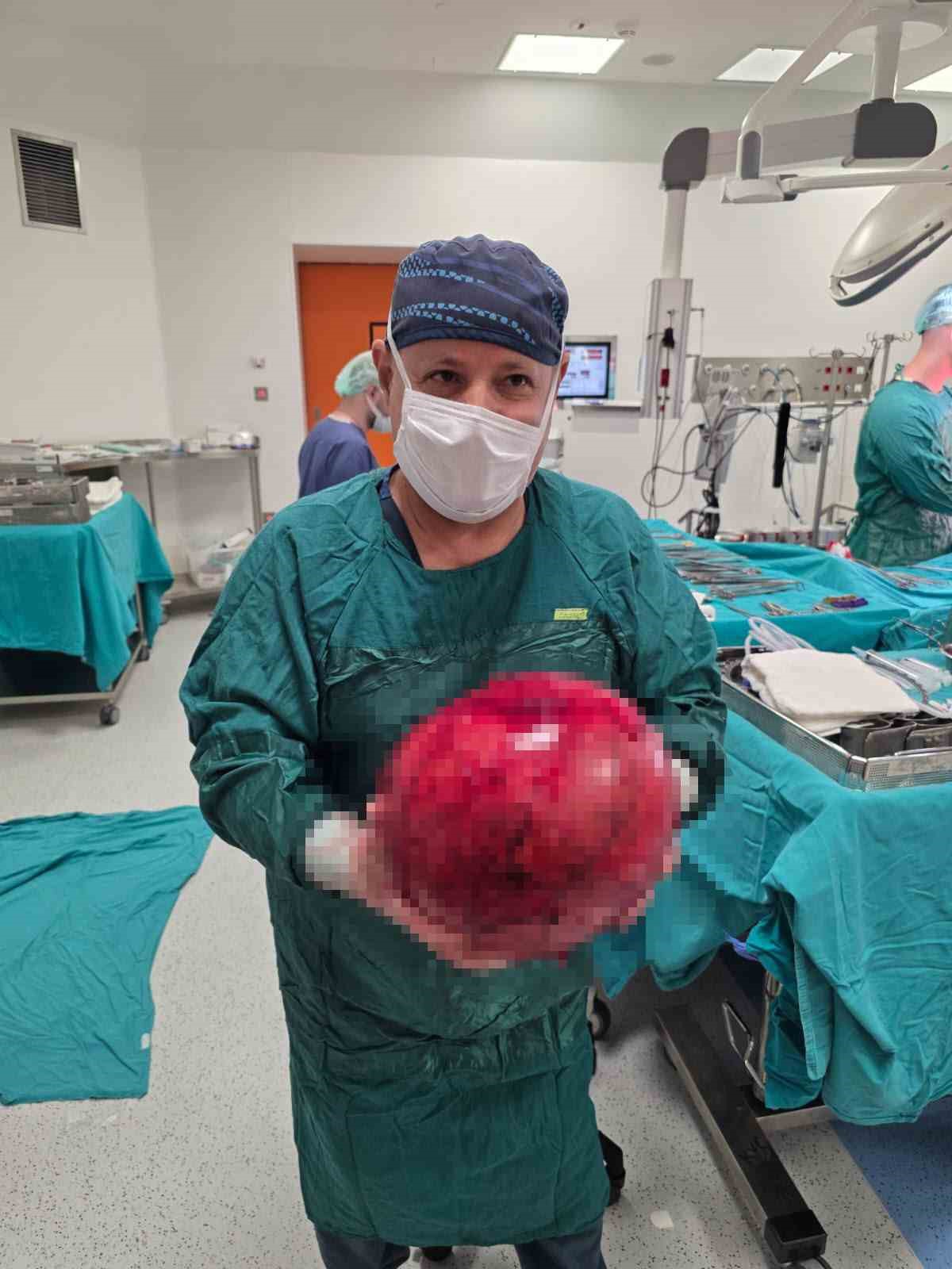 doktorlar gozlerine inanamadi 15 yil erteledigi ameliyatta karnindan dev kitle cikti 2 VJhc5WXc
