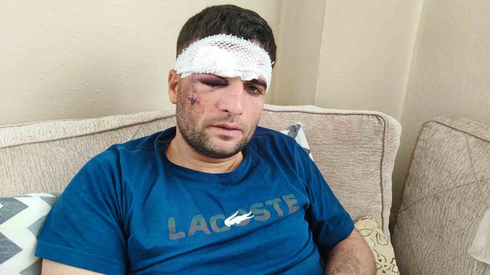 doner ustasi motosiklet surucusu kaza sonrasi kacip gittiler 3 OUaj3Sud