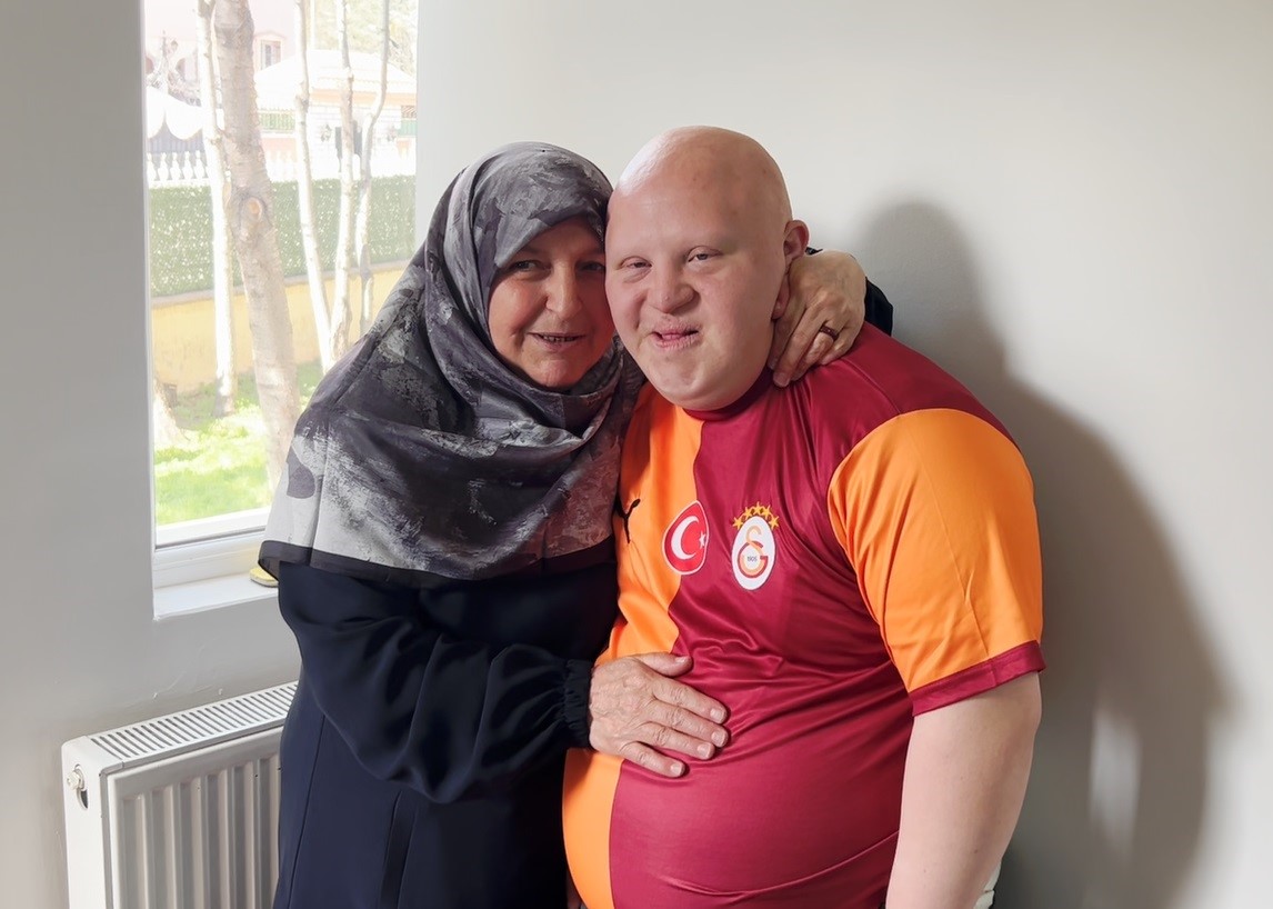down sendromlu annesinin sosyal alan ve anlayis istegi 0 LYwNSMiS