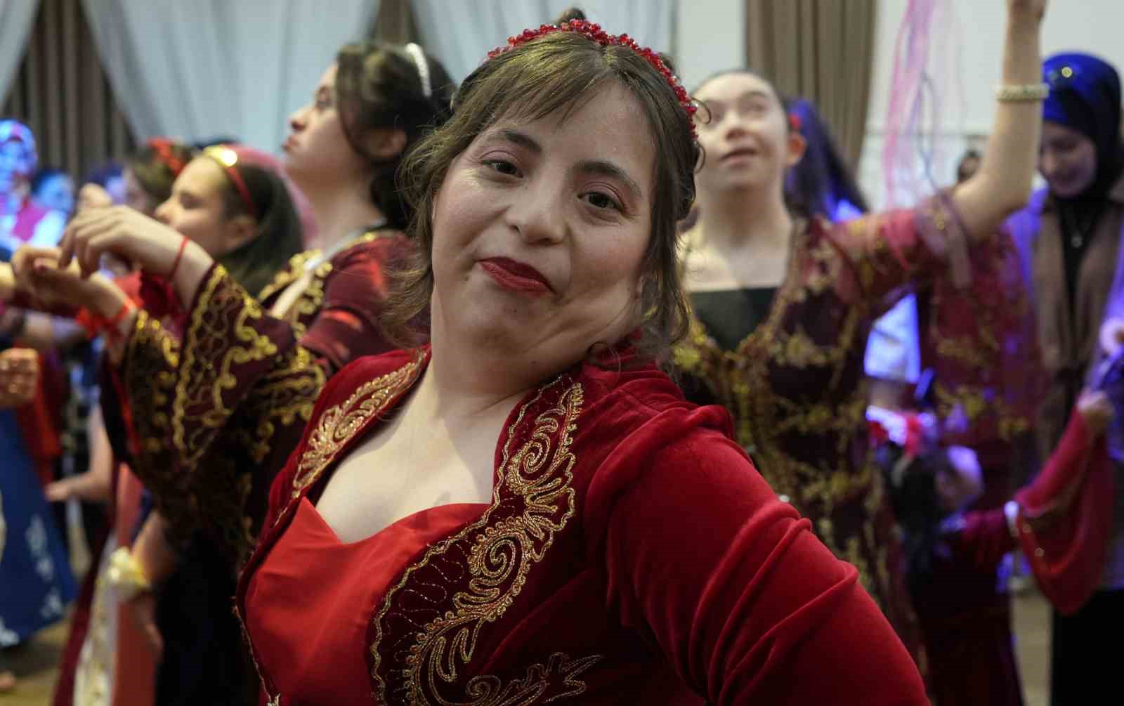 down sendromlu genc kizlarin kina hayali gercek oldu 2 fUiLdCn6