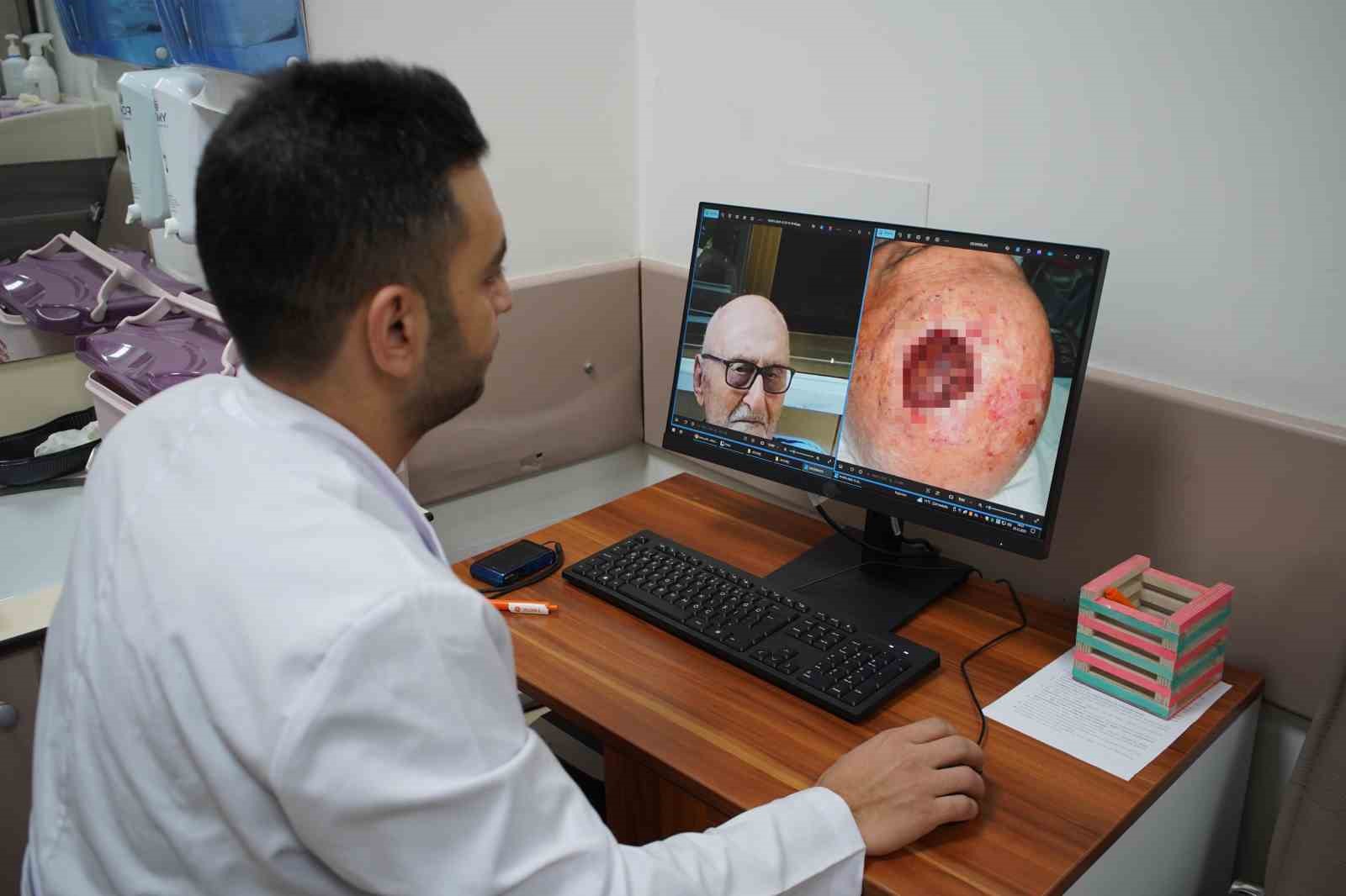 dunyada 3uncu kez rastlandi sacli derideki nadir tumor sakaryada tedavi edildi 0 y1tL5iy2