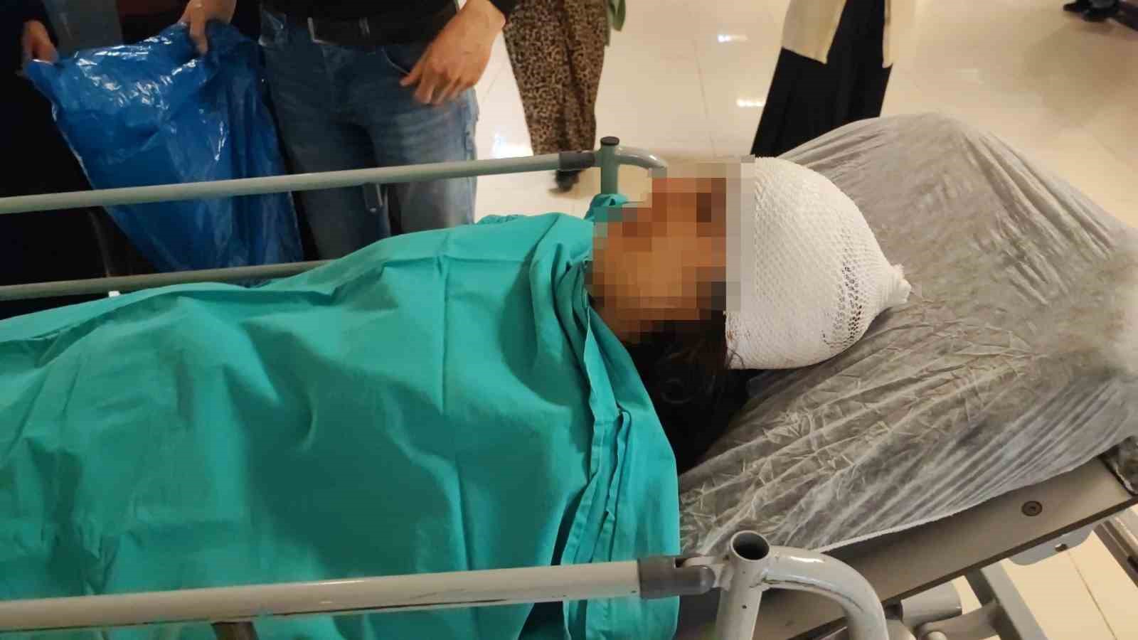 ekmek almaya giderken sokak kopeklerinin saldirisina ugrayan genc kiz yaralandi 0 Cl5UcvB8