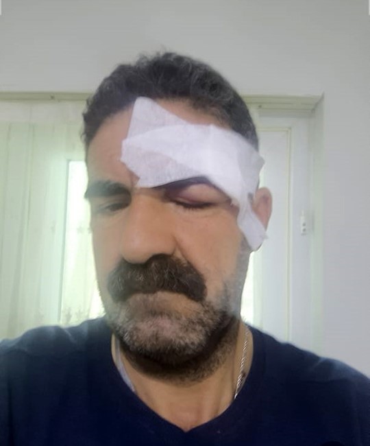 elazigdaki kavga tuvaletini duvara yapan yolcu nedeniyle cikmis 4 MRzi1i2X