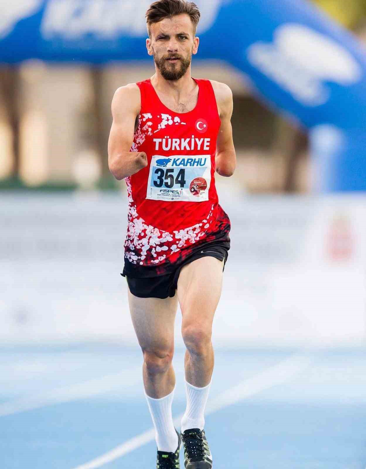 ellerini kaybetti hayata daha cok sarildi 6 2ifbfpKO