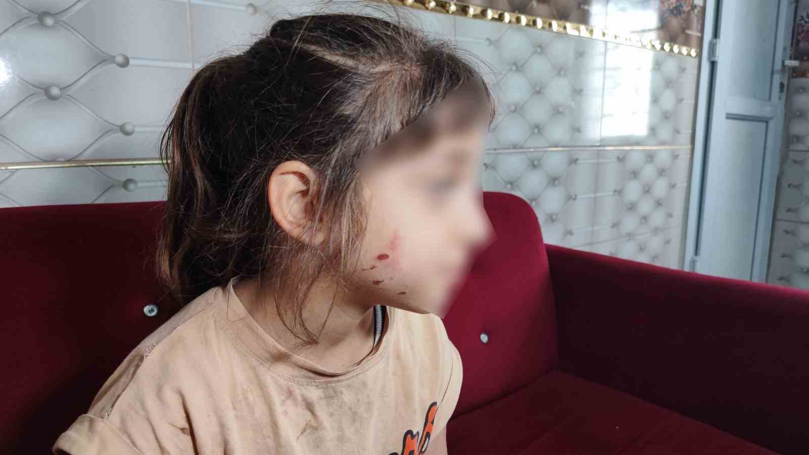 epilepsi hastasi kizi dovdugu one surulen anne benim kizimi dovduler ben konusmaya gittim kavga FFEOBDgV