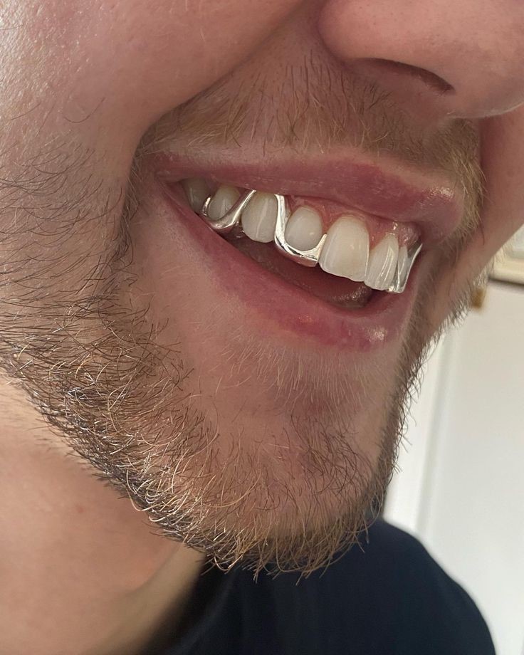 erkeklerde dis estetiginde yeni moda grillz 1 KsuEgawm
