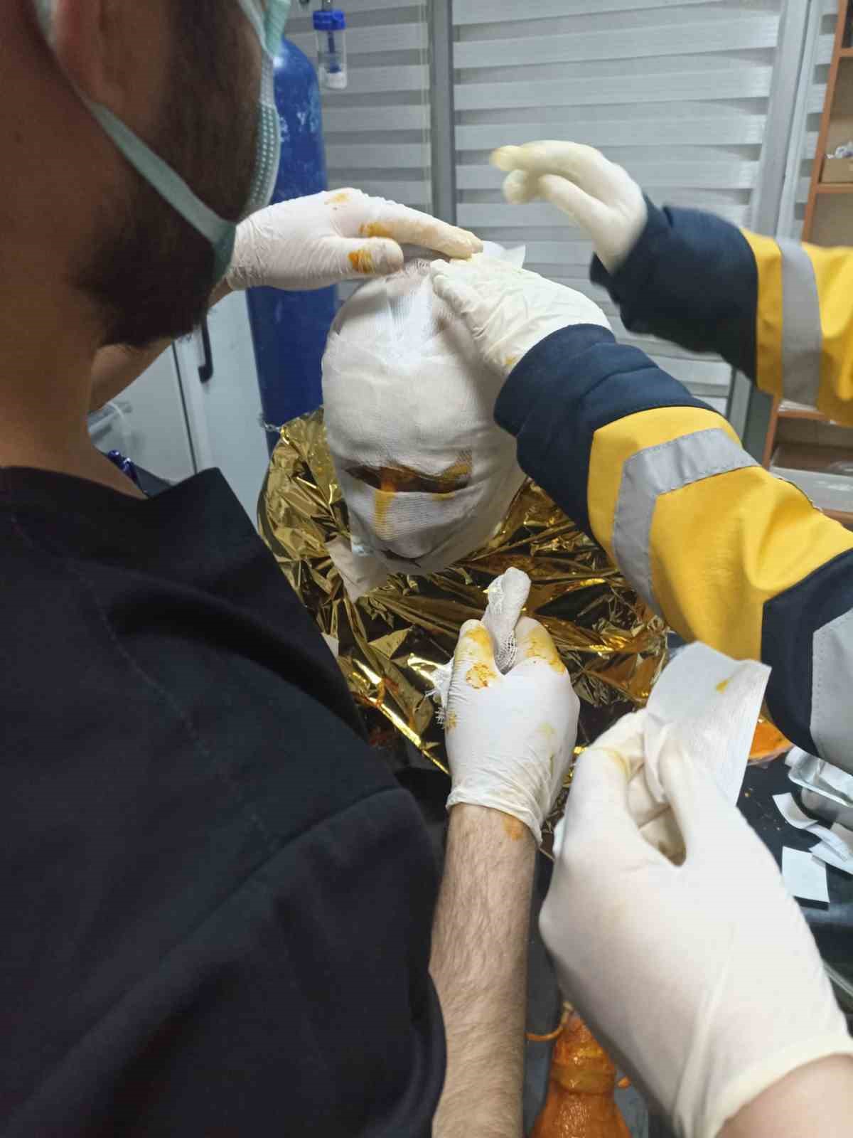 erzincanda komur ocaginda yangin 2 isci yarali 0 kGy7hTLB