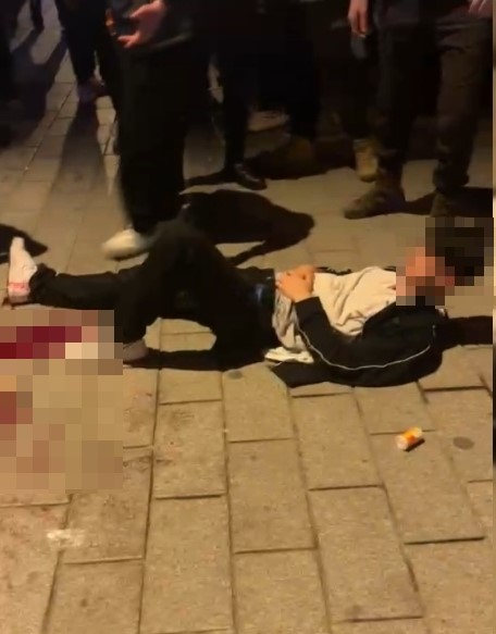 esenyurtta sampiyonluk kutlamasinda bir taraftar bacagindan bicaklandi 1 TYTBsZK3