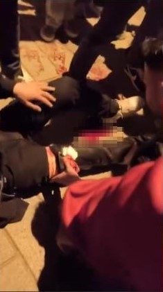 esenyurtta sampiyonluk kutlamasinda bir taraftar bacagindan bicaklandi 2 isjtZWcy