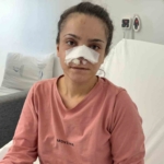 esinin-kopardigi-burnu-basarili-operasyonla-yerine-dikildi-uOzwPjqZ.jpg