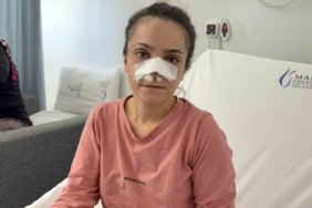 Antalya’da yangında ev sahibi ve bir itfaiye eri dumandan etkilendi 1 thumbnail
