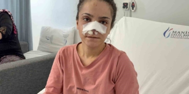 esinin-kopardigi-burnu-basarili-operasyonla-yerine-dikildi-uOzwPjqZ.jpg