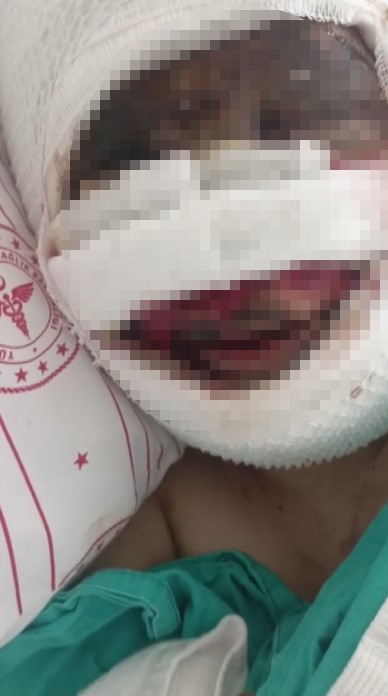 eski esi tarafindan vahsete ugrayan kadin o anlari anlatti acili baba sert tepki gosterdi O4Dd139h