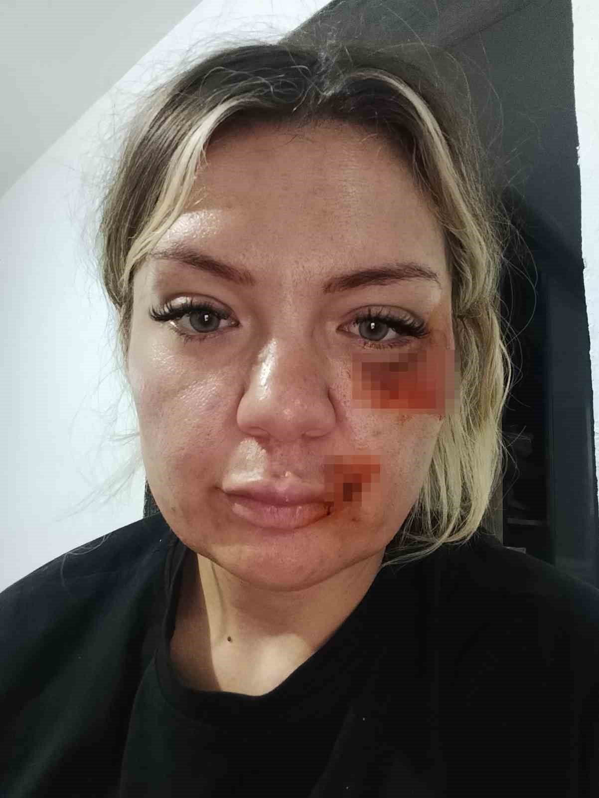 Eski sevgilisinin elinden kırılan bıçakla kurtuldu 6 eski sevgilisinin elinden kirilan bicakla kurtuldu 2 icf7ruz3