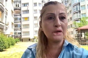 estetik-islem-sonrasi-dudagi-curudu-7-yildir-hukuk-mucadelesi-veriyor-f7zVx7nI.jpg