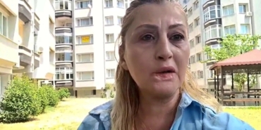 estetik-islem-sonrasi-dudagi-curudu-7-yildir-hukuk-mucadelesi-veriyor-f7zVx7nI.jpg