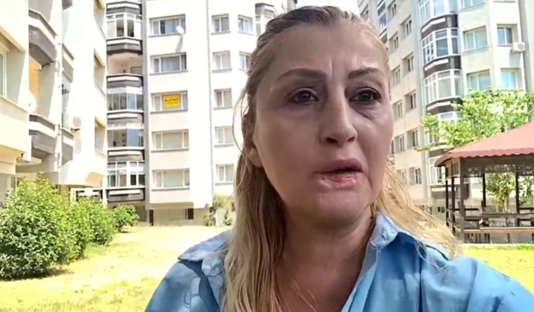 estetik-islem-sonrasi-dudagi-curudu-7-yildir-hukuk-mucadelesi-veriyor-f7zVx7nI.jpg