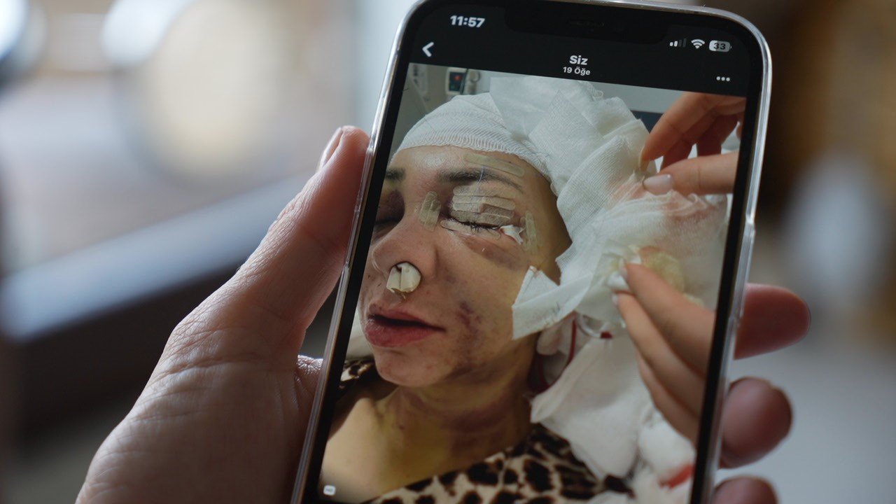 feci sekilde darp edilmisti yasadigi dehseti unutamiyor 2