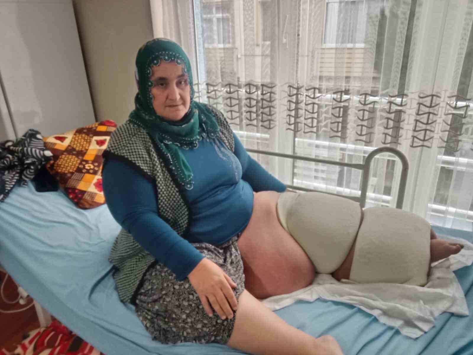 fil hastaligi bacagini 100 kilo yapti tedavisinin devami icin destek bekliyor 1 HRsHNHlq