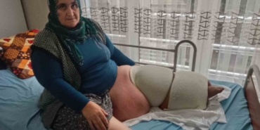fil-hastaligi-bacagini-100-kilo-yapti-tedavisinin-devami-icin-destek-bekliyor-R4atBbhx.jpg