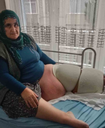 fil-hastaligi-bacagini-100-kilo-yapti-tedavisinin-devami-icin-destek-bekliyor-R4atBbhx.jpg