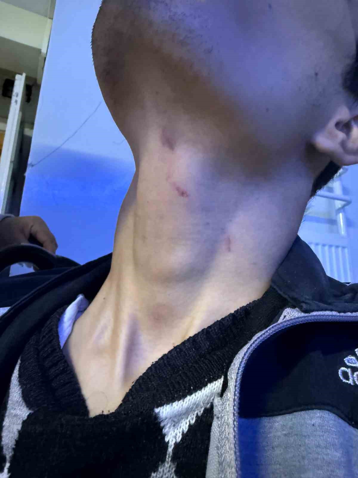 gaziantepte engelli bakim merkezinde darp skandali merkezde kalan gencin kafasina 6 dikis atildi 7 gJhklELW