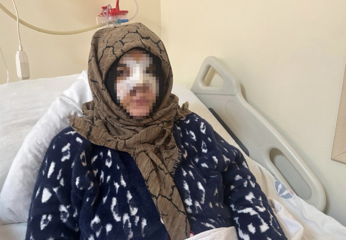 Gaziantep’te eşinin yüzünü taşla ezip darbeden sanık ağır cezada yargılanacak 5 gaziantepte esinin yuzunu tasla ezip darbeden sanik agir cezada yargilanacak 1 E6FMqTU2