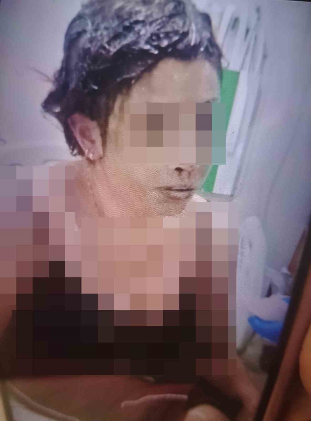 gaziantepte vahset eski esini kezzapla agir yaraladi 4 KznVnCz4