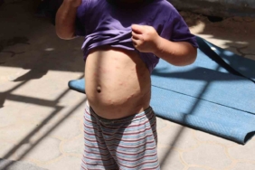 BM Genel Kurulu’ndan İsrail’in Gazze’ye insani yardımların ulaştırılmasına tamamen izin vermesine ilişkin karara onay 1 thumbnail