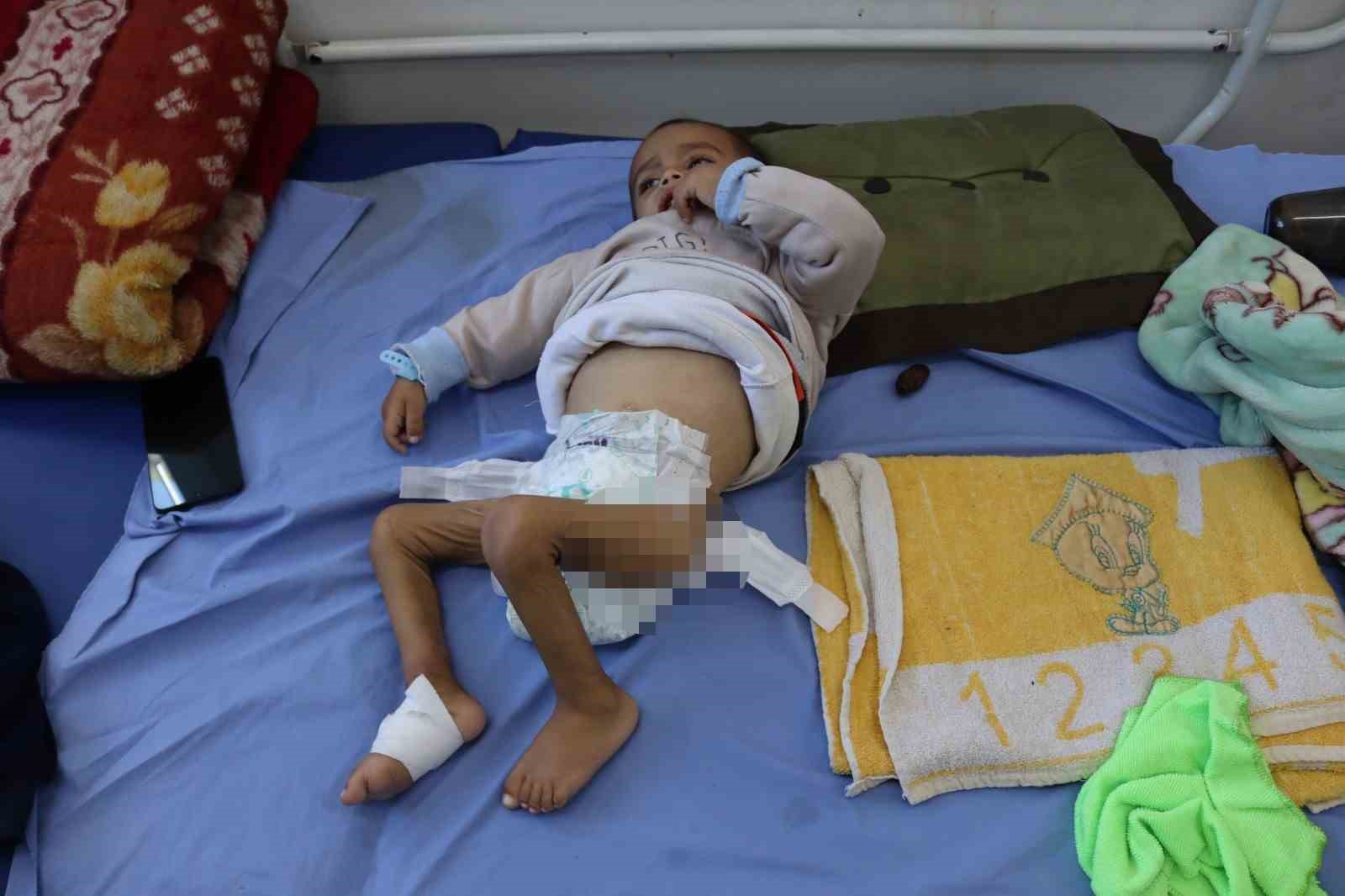 gazzeli cocuklar ateskesin golgesinde aclikla savasiyor 0 vylBBs8F