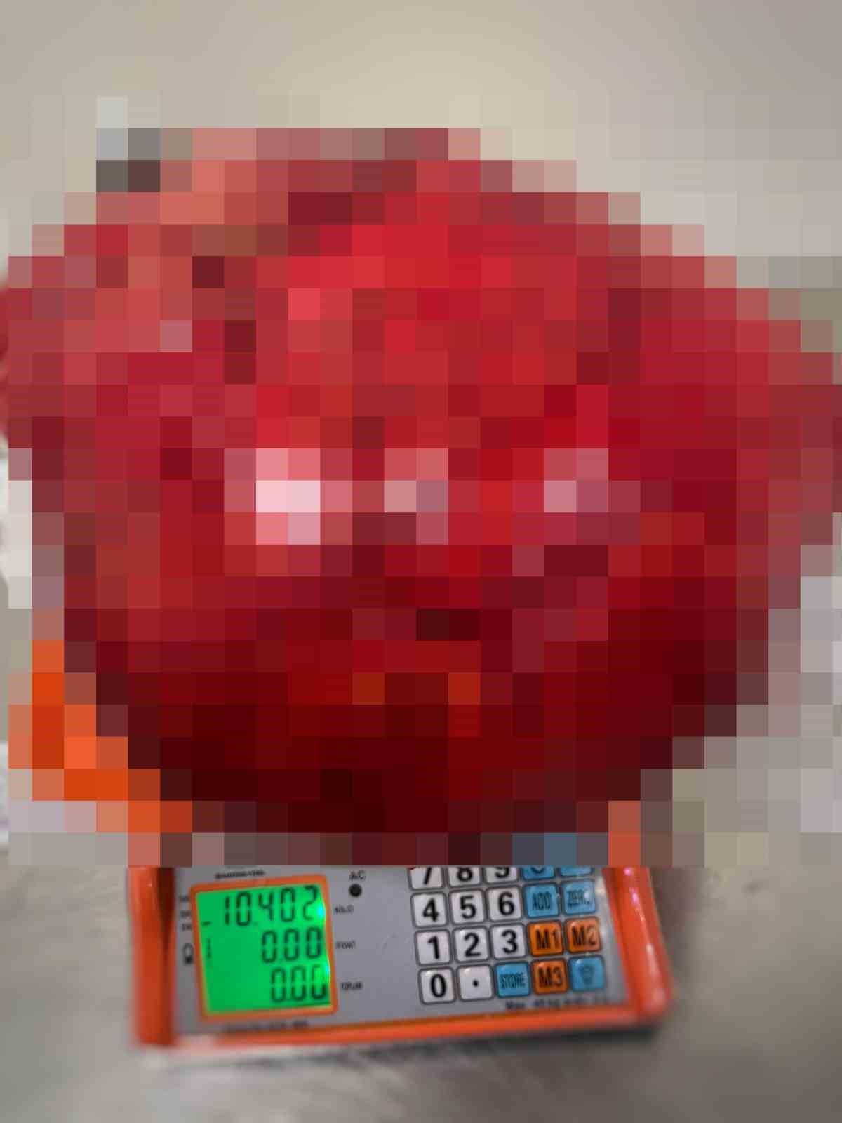 gorenler kilo aldi sandi karnindan 30 santim uzunlugunda 105 kiloluk kitle cikti 3