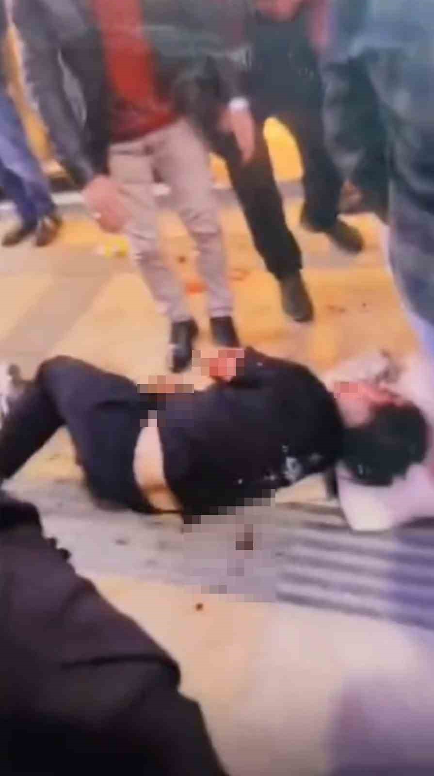 gumushanede bosanma asamasindaki esi tarafindan bicaklanan kadin yaralandi 2 XBkTtq7Y