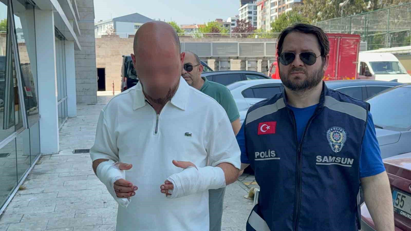 Güzellik merkezinde eski eşini hastanelik eden berbere gözaltı 5 guzellik merkezinde eski esini hastanelik eden berbere gozalti 1 j2hH6bmf