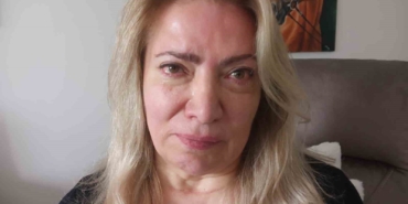 guzellik-merkezinde-estetik-operasyonu-yuz-felci-yapti-hOFbi9SA.jpg