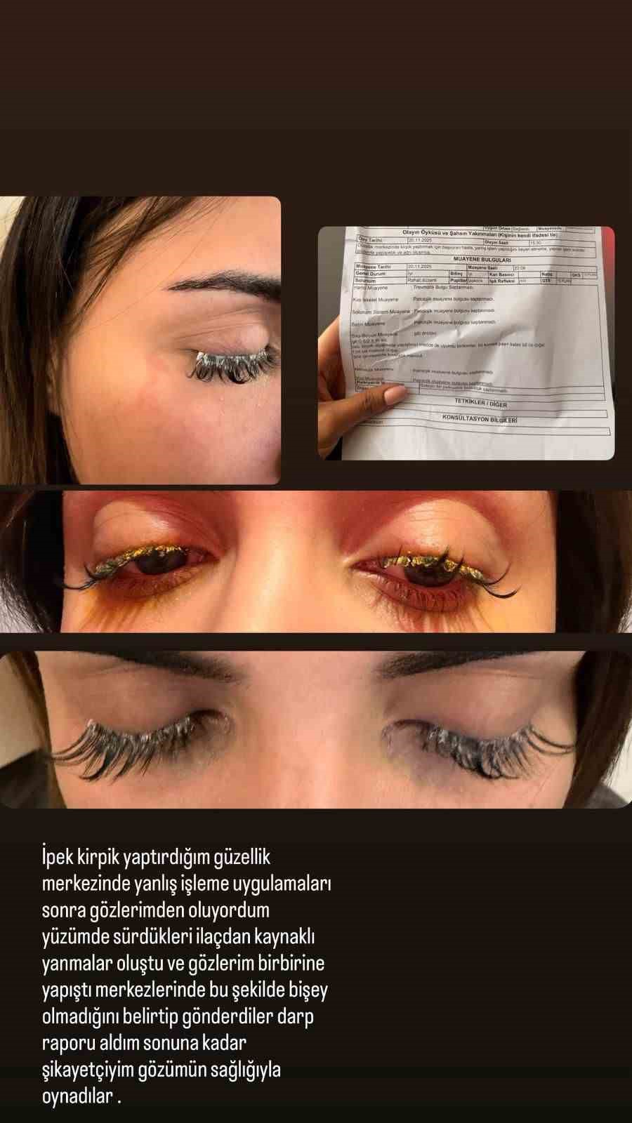 Güzellik merkezinde genç kadının gözüne yapıştırıcı kaçtı: "Kör olabilirdim" 6 guzellik merkezinde genc kadinin gozune yapistirici kacti kor olabilirdim 2 dA8fpFTh