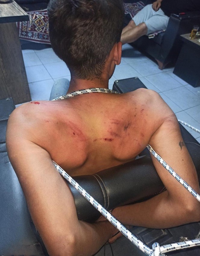 Hamam böceği yedirilen gencin dosyasında karar: Yağmadan beraat, hürriyeti tehditten 6 yıl 12 ay ceza 6 hamam bocegi yedirilen gencin dosyasinda karar yagmadan beraat hurriyeti tehditten 6 yil 12 ay qClDZuhq
